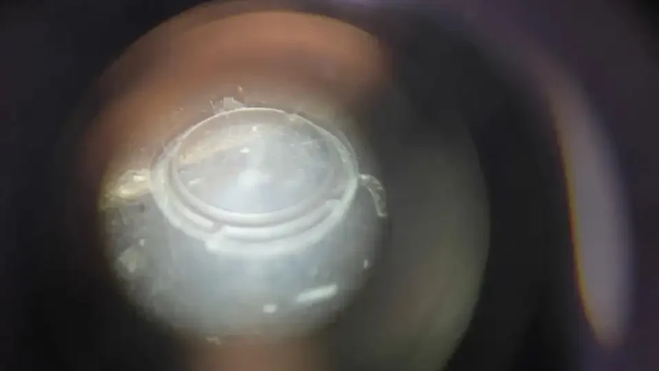 eye-implant-rnd-3